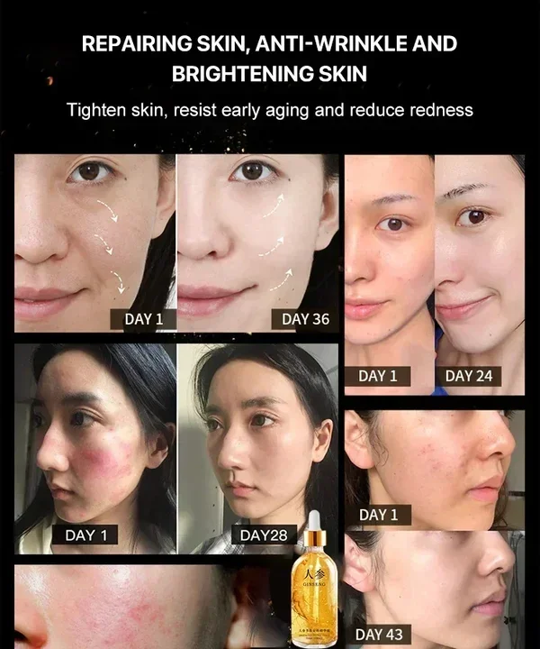 🔥LAST DAY 49% OFF🔥 Ginseng Polypeptide Anti-Ageing Essence