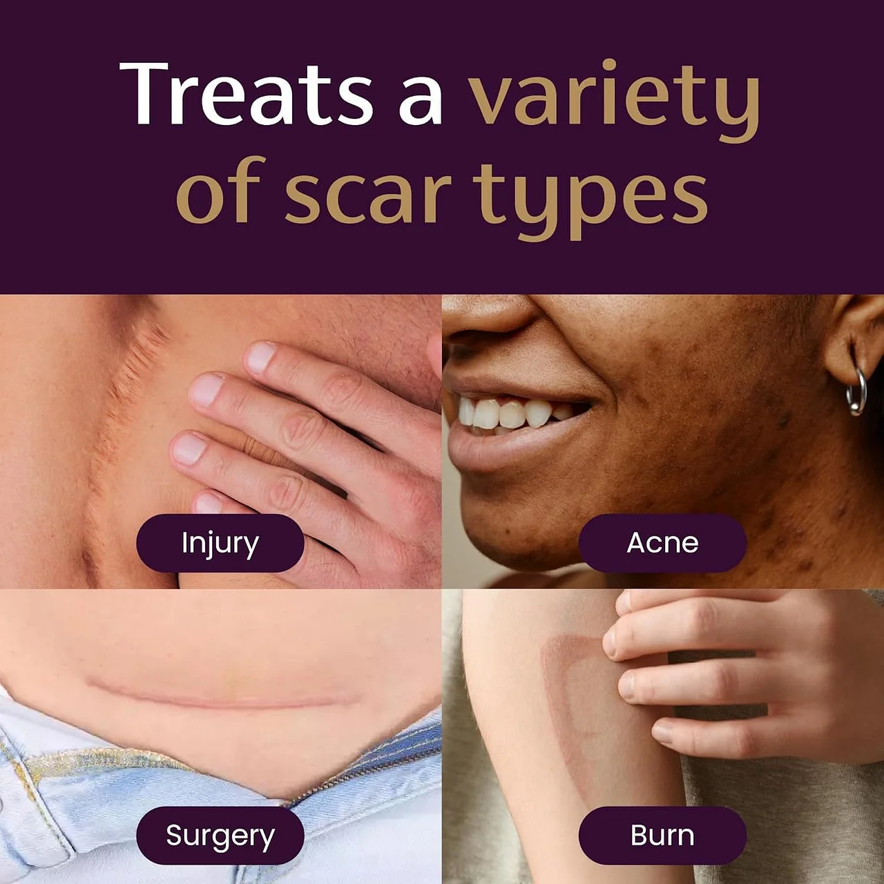 NESLEMY™ Advanced Scar Gel