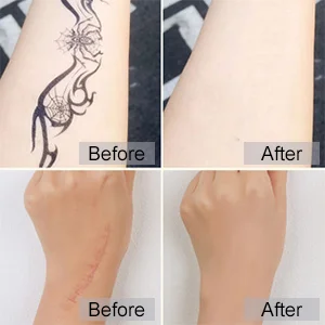 Tattoo Concealer, Tattoo Cover, Tattoo Remover, Body Concealer, Concealer To Cover Tattoo/Scar/Birthmarks/Vitiligo, Professional Waterproof Tattoos Cover Up Makeup Concealer Set: Amazon.co.uk: Beauty