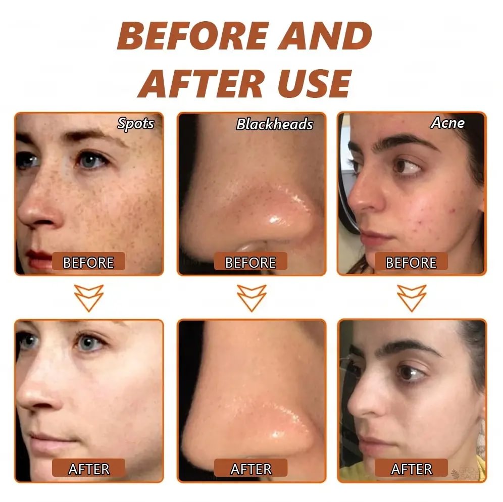 	Zakdavi&trade; Radiant Whitening & Spot Eraser Mask