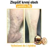 🧑&zwj;⚕️O&scaron;etrenie kožn&yacute;ch probl&eacute;mov zahňa: vekov&eacute; &scaron;kvrny, jazvy, bradavice, kožn&eacute; akn&eacute;, furuncle, akn&eacute;, ekz&eacute;my, psori&aacute;za, acne inversa, akn&eacute;, jazvy po akn&eacute; a in&eacute;.