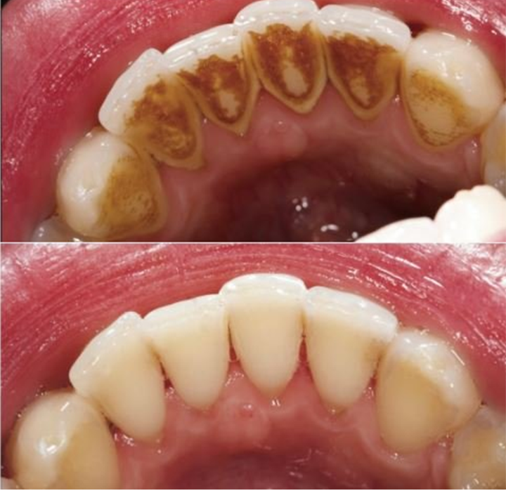 Rosopl® Multi-Action Oral Care Essence 25