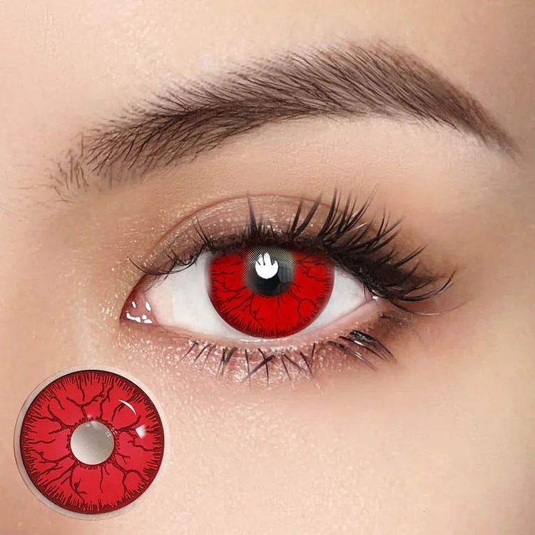 7 Reasons Your Contacts Are Giving You Red Eyes - Sin Chew Optics