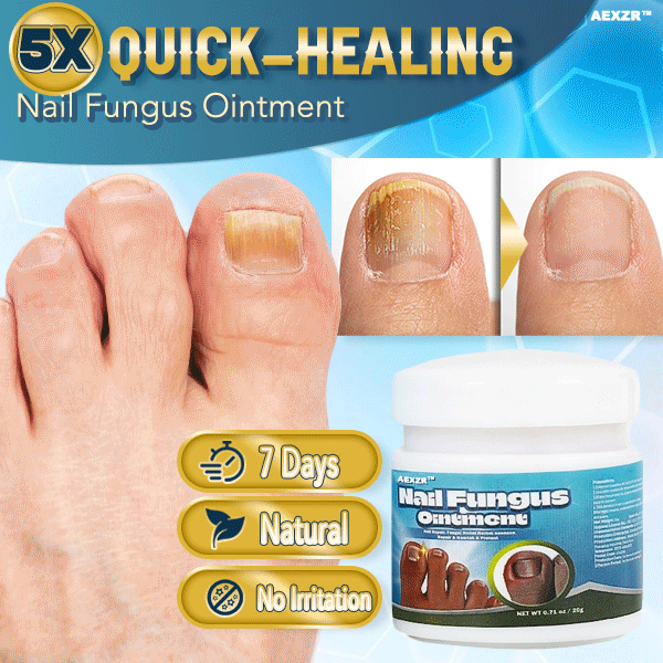 Quick-healing Nail Fungus Ointment 