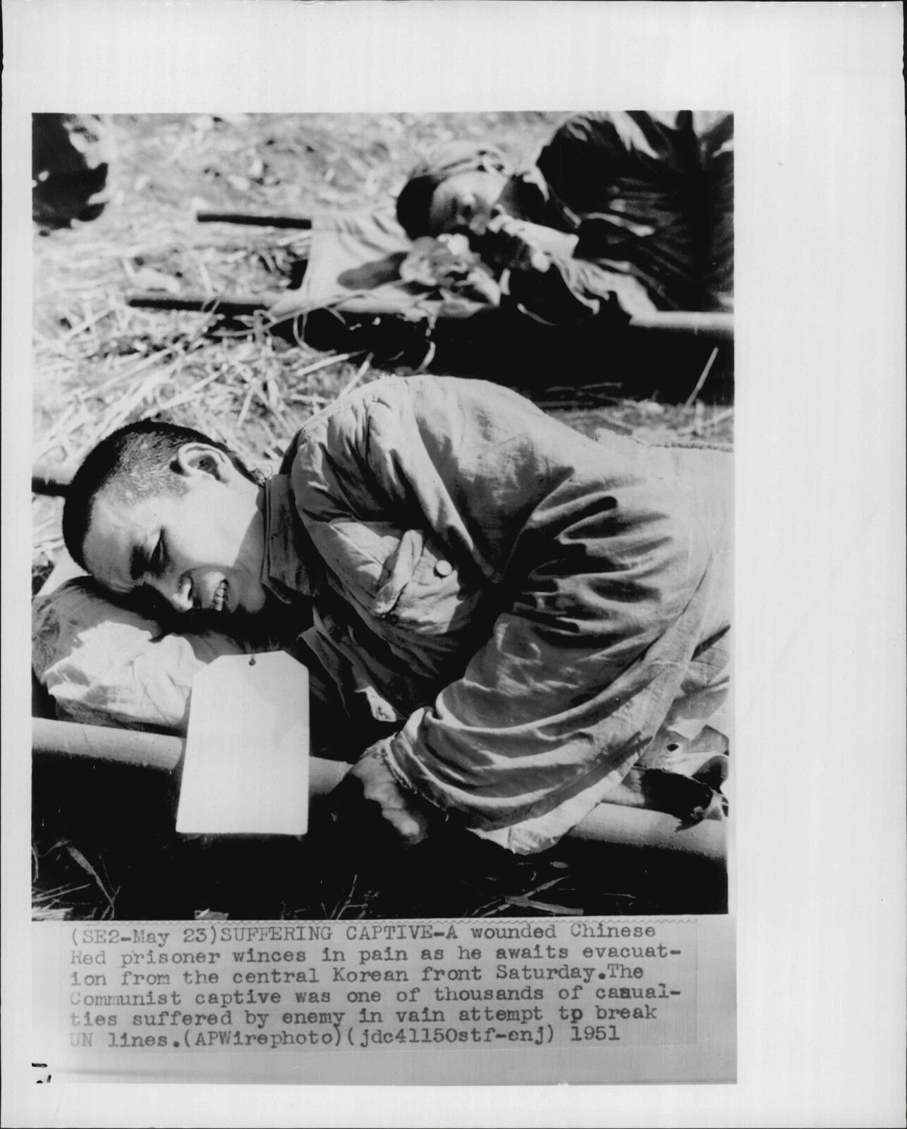 Wounded Chinese Prisoner Awaits Evacuation 1951 Korea War Press Photo Poster painting