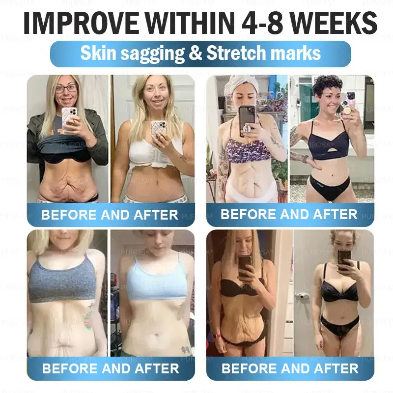 	CrazyLeaf&reg; Sculpting Microneedle Patch