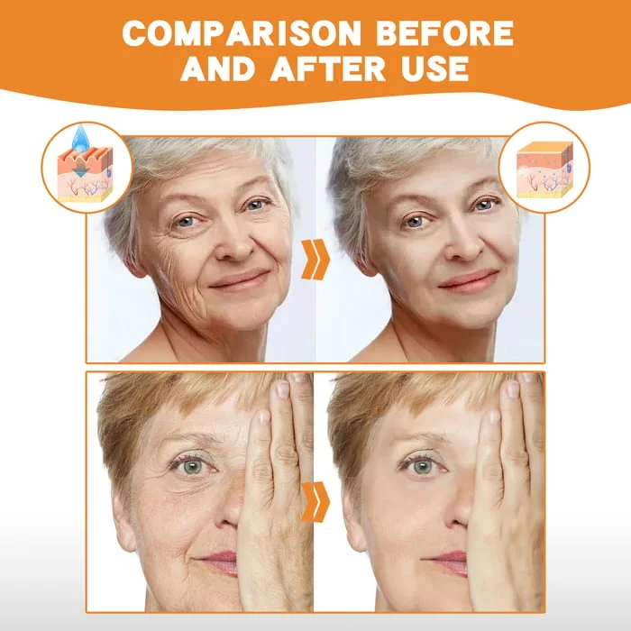 2025 New Instant Skin Essence Collagen Set