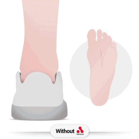 Đế gi&agrave;y Protalus | C&ocirc;ng nghệ đế gi&agrave;y Cải thiện cuộc sống từng bước một