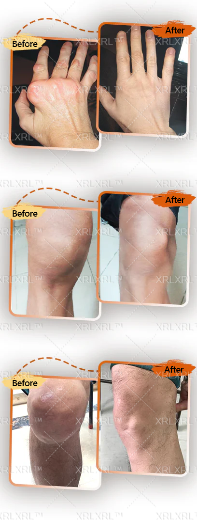 Alcuras® Bee Venom Pain-Relief Bone Healing Cream 🇺🇸(Specially for older adults)