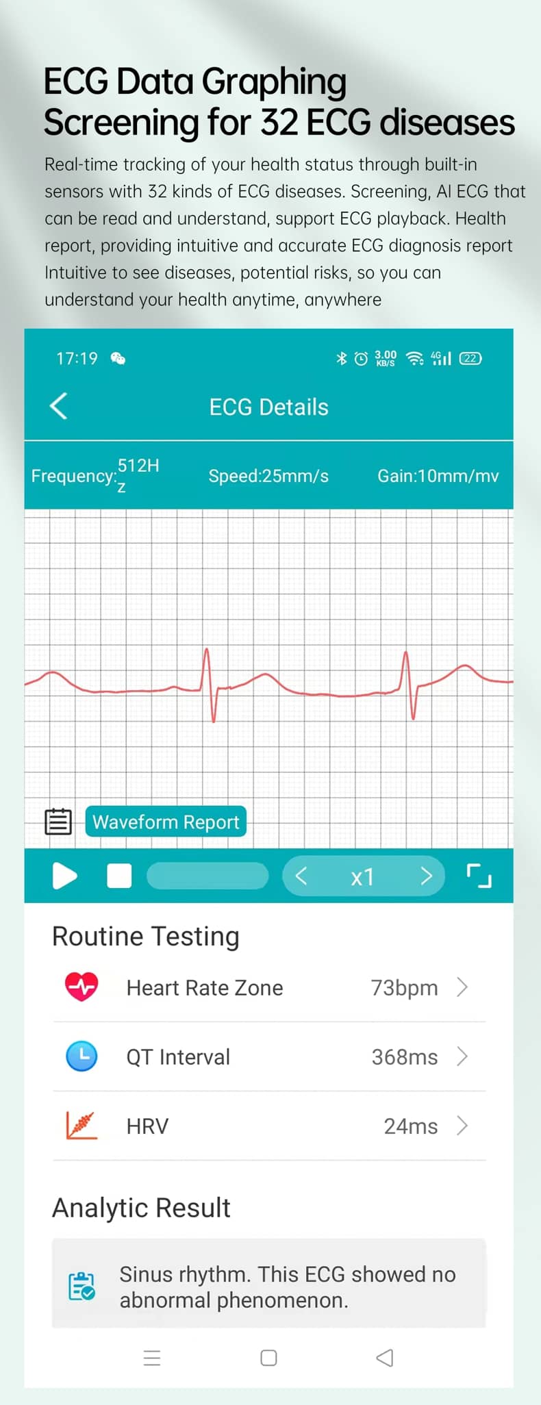 Findtime ECG Smart Watch Monitor Blood Pressure SpO2 Heart Rate Blood Glucose Body Temperature