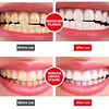 🎁2025 HOT SALE🔥SP-6 Probiotic Whitening Toothpaste