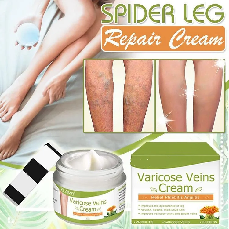 Varicose Veins Cream