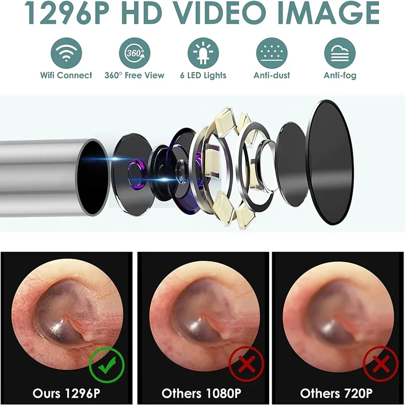 Last Day 50% Off✨Wireless Visible Ear Cleaner