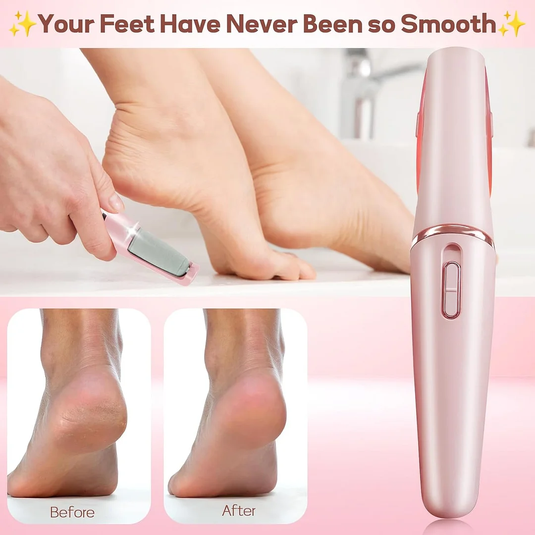 🎁Vishopee™ - Electric Callus Pedicure Foot Grinder | 50% discount temporarily