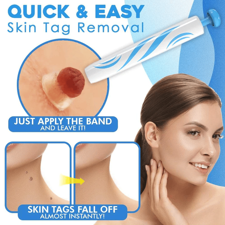 🔥Auto Tag Rapid Removal Kit🔥