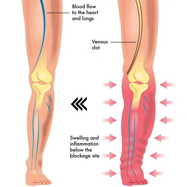 Magnetic LymphTherapy Detox Bracelet（Limited time discount 🔥 last day）