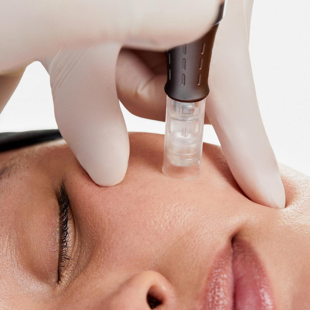 How Dr. Pen Microneedling Works