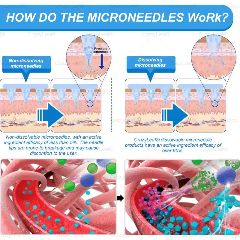 	CrazyLeaf&reg; Sculpting Microneedle Patch