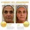 🧑&zwj;⚕️O&scaron;etrenie kožn&yacute;ch probl&eacute;mov zahňa: vekov&eacute; &scaron;kvrny, jazvy, bradavice, kožn&eacute; akn&eacute;, furuncle, akn&eacute;, ekz&eacute;my, psori&aacute;za, acne inversa, akn&eacute;, jazvy po akn&eacute; a in&eacute;.