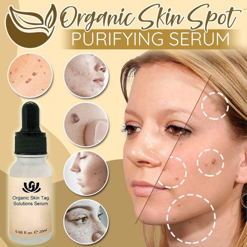 Organic Skin Spot Solution