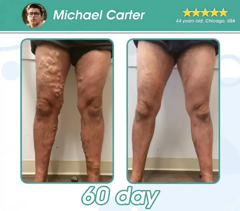 Nanpusa&reg; GLP-1 Slimming Essence Pearls