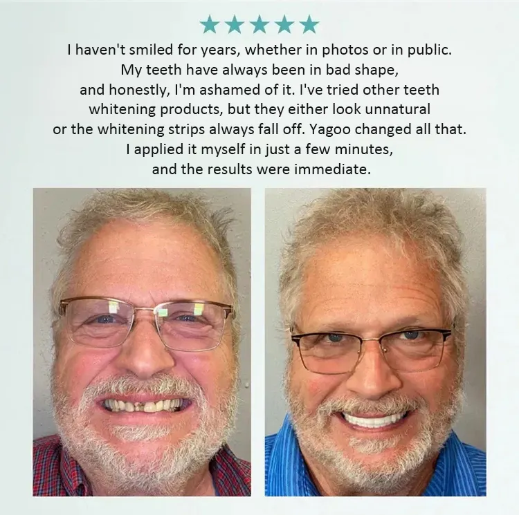 【All-Inclusive Customisation Package】Denture Care and Enhancement Kit