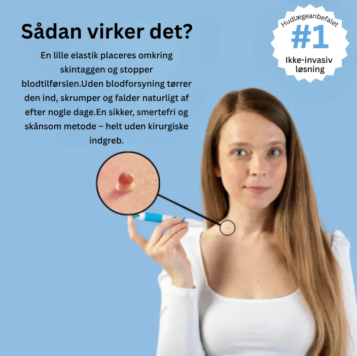 TagBuddy Kit - Slut med skin tags