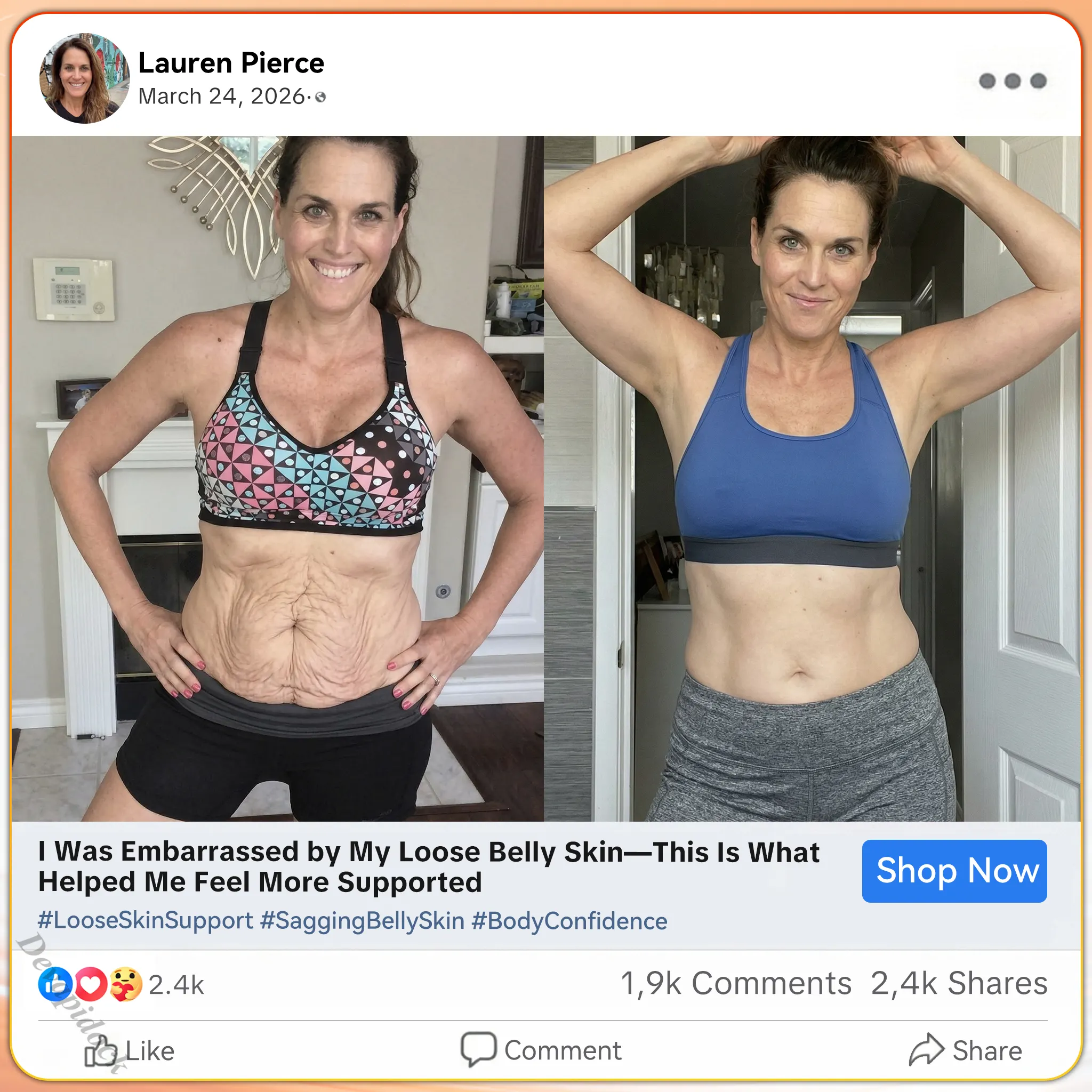 Before and after firmer skin